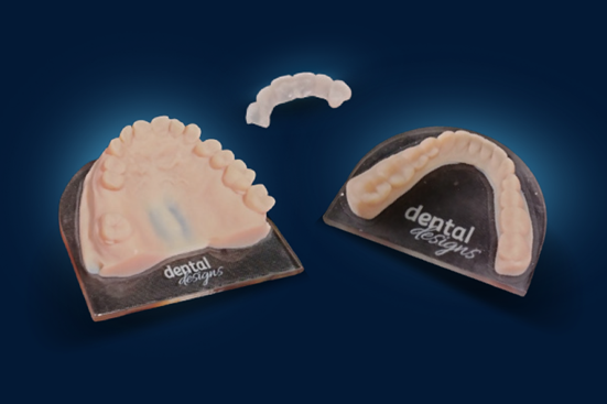 Pushing the boundaries of digital dentistry with Stratasys dental 3D printing technology